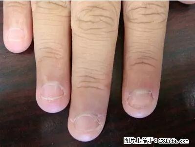 剪指甲、挖耳屎，这些日常小动作竟隐藏大危害！ - 三亚生活资讯 - 三亚28生活网 sanya.28life.net